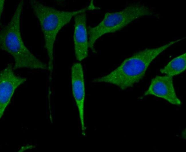 PFKM Antibody in Immunocytochemistry (ICC/IF)