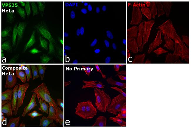 VPS35 Antibody in Immunocytochemistry (ICC/IF)