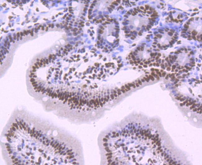 SF3B1 Antibody in Immunohistochemistry (Paraffin) (IHC (P))