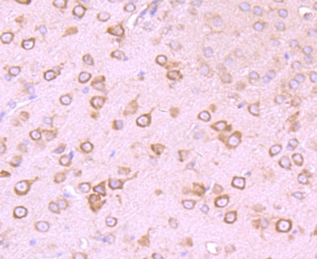 GABRA5 Antibody in Immunohistochemistry (Paraffin) (IHC (P))