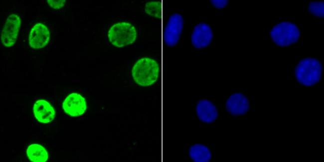 hnRNP U Antibody in Immunocytochemistry (ICC/IF)