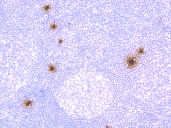 Mast Cell Chymase Antibody in Immunohistochemistry (Paraffin) (IHC (P))