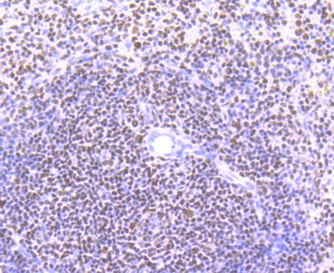 IKAROS Antibody in Immunohistochemistry (Paraffin) (IHC (P))