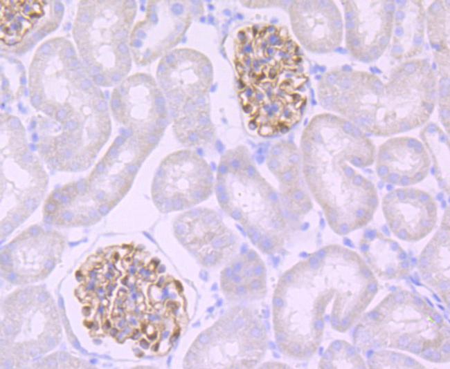 Podocin Antibody in Immunohistochemistry (Paraffin) (IHC (P))