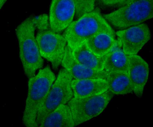 Cytochrome P450 Reductase Antibody in Immunocytochemistry (ICC/IF)