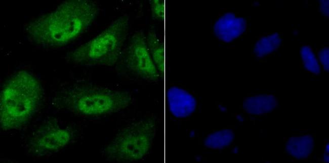 PSMB8 Antibody in Immunocytochemistry (ICC/IF)