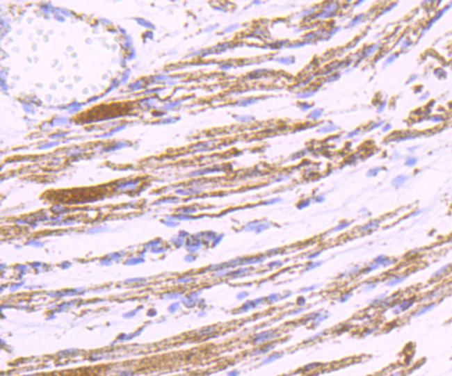 PDK2 Antibody in Immunohistochemistry (Paraffin) (IHC (P))