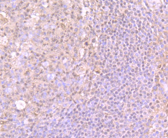 PU.1 Antibody in Immunohistochemistry (Paraffin) (IHC (P))