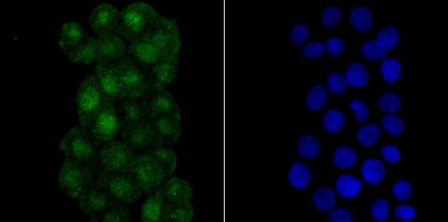 RPA70 Antibody in Immunocytochemistry (ICC/IF)