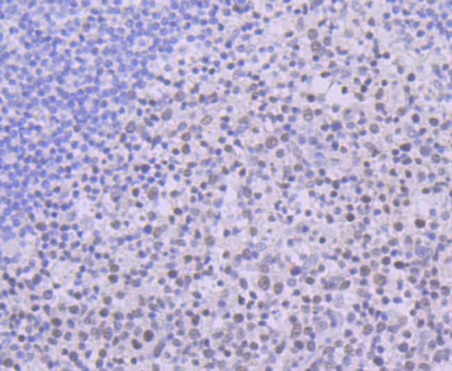 USP7 Antibody in Immunohistochemistry (Paraffin) (IHC (P))