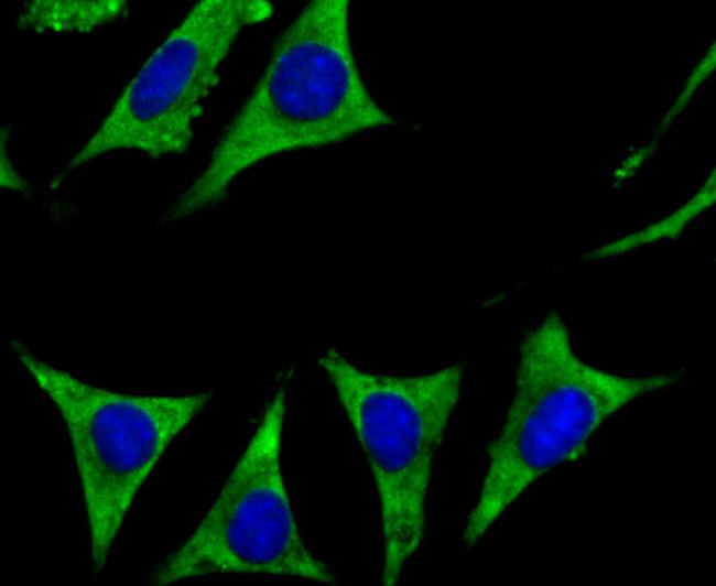 CYP17A1 Antibody in Immunocytochemistry (ICC/IF)