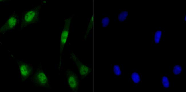 MCM3 Antibody in Immunocytochemistry (ICC/IF)