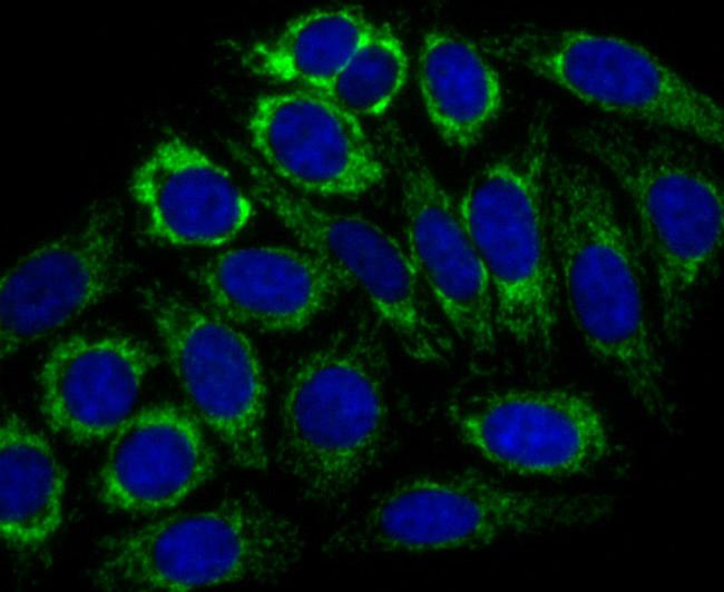 CPS1 Antibody in Immunocytochemistry (ICC/IF)