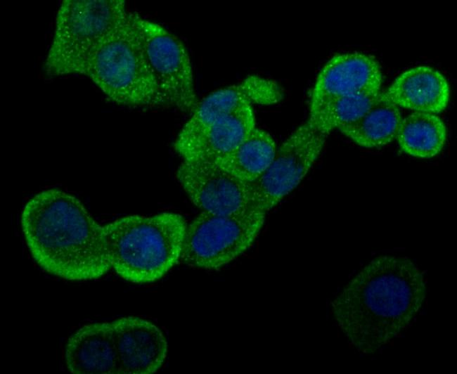 GSTP1 Antibody in Immunocytochemistry (ICC/IF)