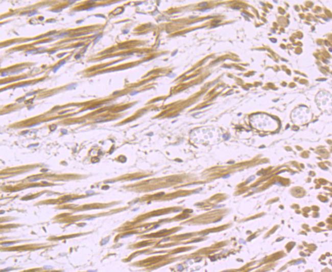 H-cadherin Antibody in Immunohistochemistry (Paraffin) (IHC (P))