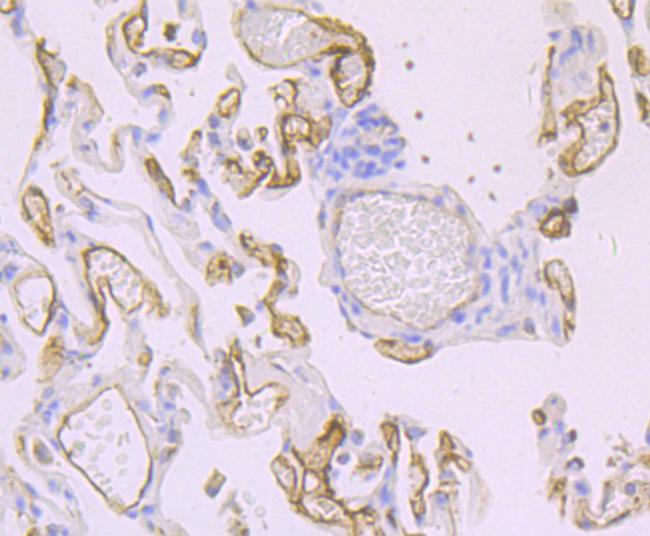 Thrombomodulin Antibody in Immunohistochemistry (Paraffin) (IHC (P))