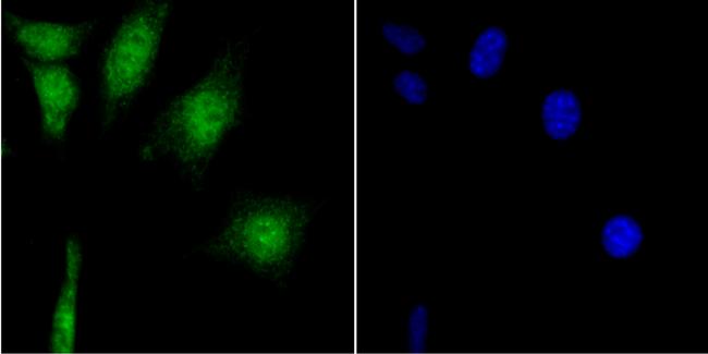 CaMKIV Antibody in Immunocytochemistry (ICC/IF)