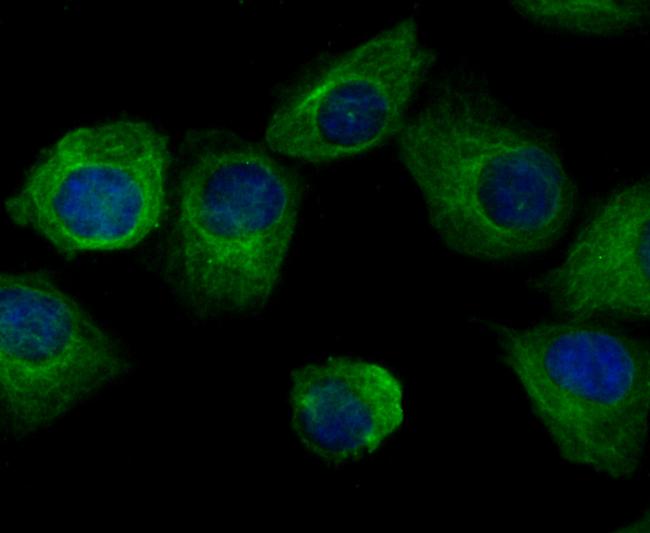 Arp3 Antibody in Immunocytochemistry (ICC/IF)