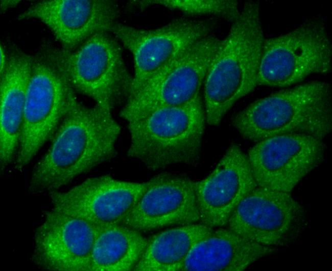 GPI Antibody in Immunocytochemistry (ICC/IF)