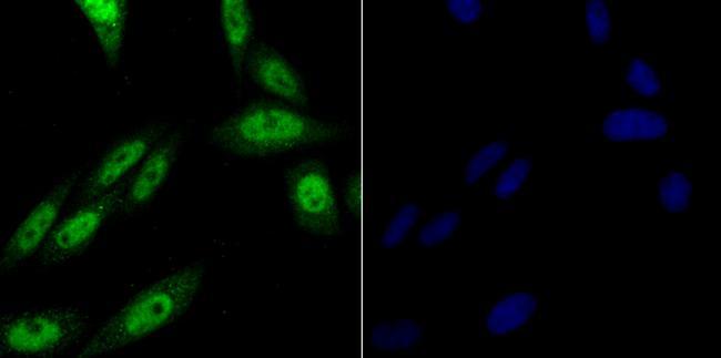 PRP8 Antibody in Immunocytochemistry (ICC/IF)