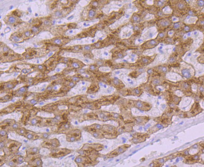 TFR2 Antibody in Immunohistochemistry (Paraffin) (IHC (P))