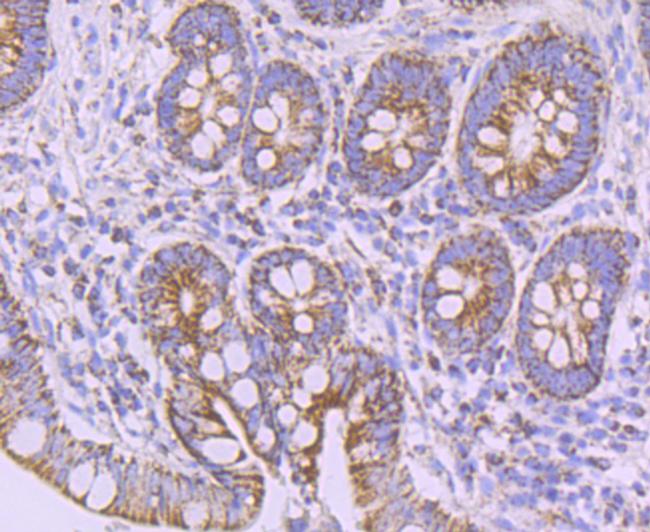 NDUFB8 Antibody in Immunohistochemistry (Paraffin) (IHC (P))