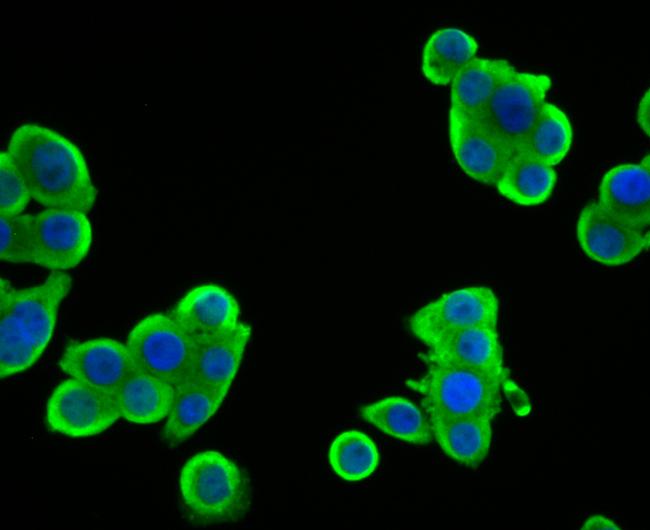 SULT2A1 Antibody in Immunocytochemistry (ICC/IF)