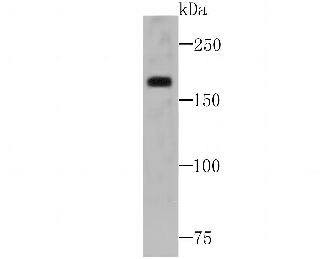 BAZ1B Antibody in Western Blot (WB)