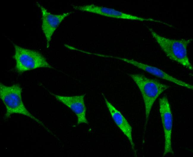 GEF-H1 Antibody in Immunocytochemistry (ICC/IF)