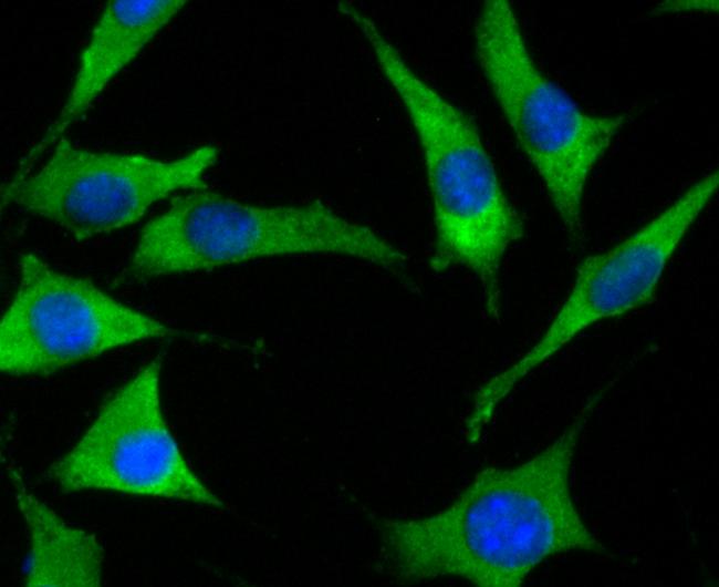 SOCS2 Antibody in Immunocytochemistry (ICC/IF)