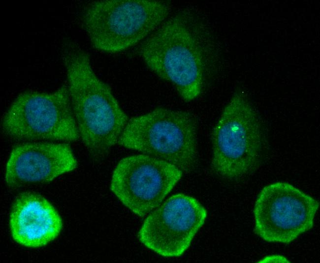 Tetranectin Antibody in Immunocytochemistry (ICC/IF)