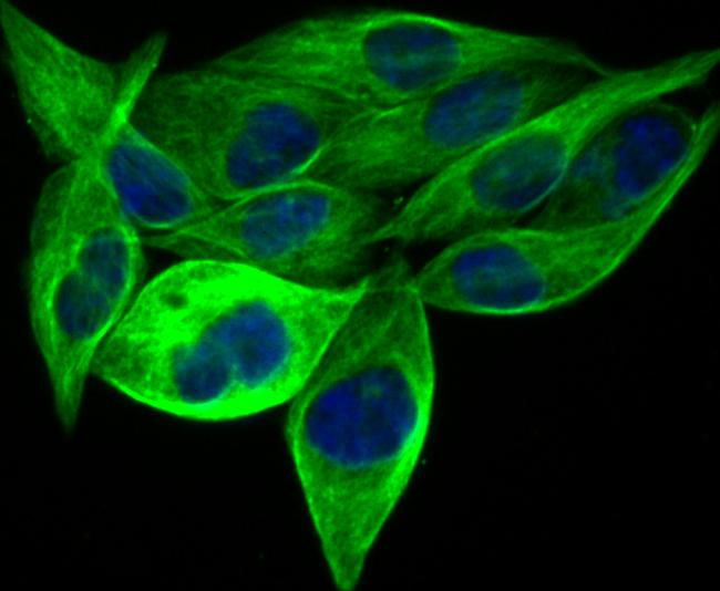 BAP31 Antibody in Immunocytochemistry (ICC/IF)