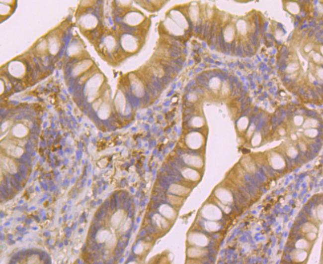 Nudel Antibody in Immunohistochemistry (Paraffin) (IHC (P))