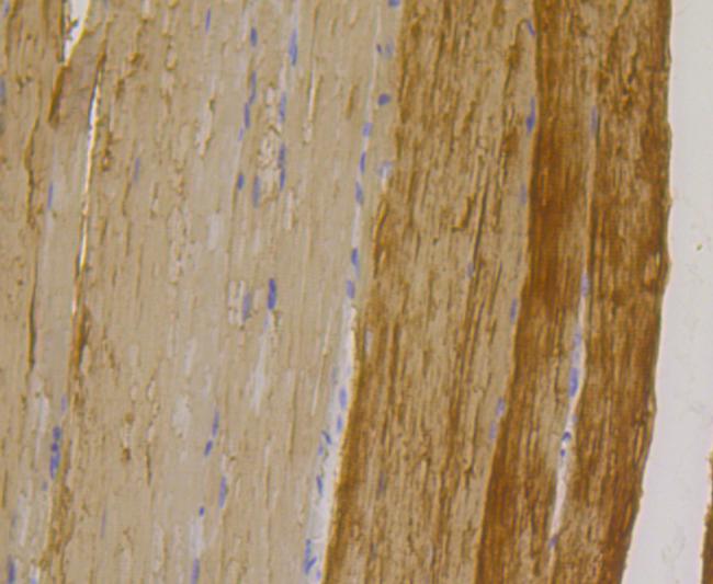 TPM1 Antibody in Immunohistochemistry (Paraffin) (IHC (P))