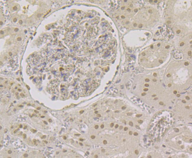 CBF beta Antibody in Immunohistochemistry (Paraffin) (IHC (P))