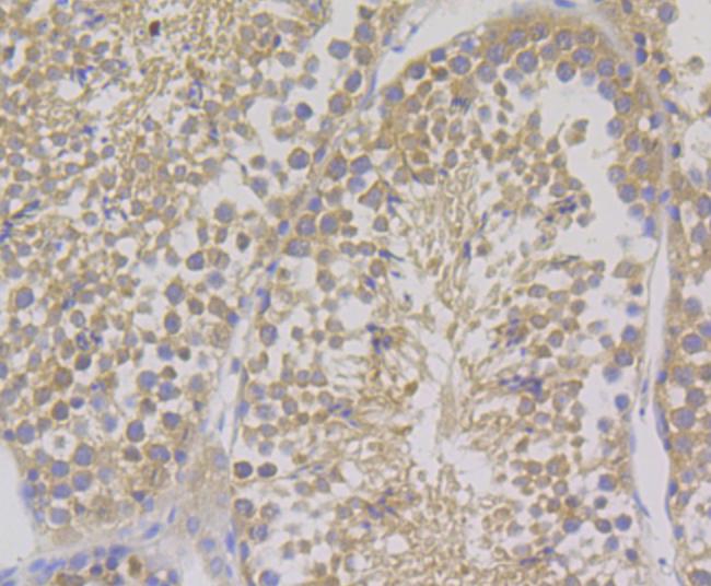 COMT Antibody in Immunohistochemistry (Paraffin) (IHC (P))