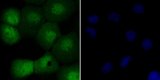 UNC84A Antibody in Immunocytochemistry (ICC/IF)