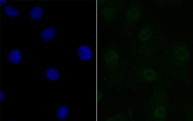 BANF1 Antibody in Immunocytochemistry (ICC/IF)