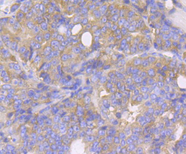 KARS Antibody in Immunohistochemistry (Paraffin) (IHC (P))