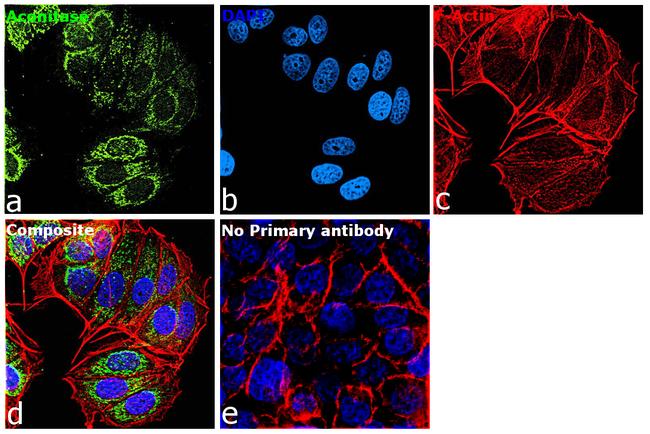 Aconitase 2 Antibody in Immunocytochemistry (ICC/IF)