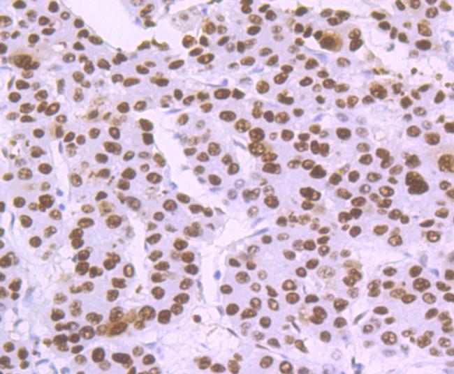 DDB2 Antibody in Immunohistochemistry (Paraffin) (IHC (P))