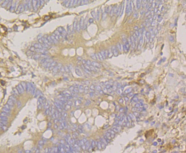 SRP54 Antibody in Immunohistochemistry (Paraffin) (IHC (P))