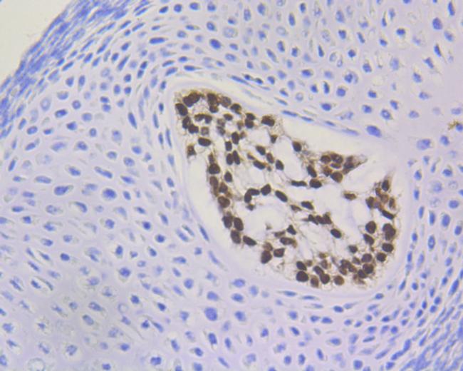 Brachyury Antibody in Immunohistochemistry (Paraffin) (IHC (P))