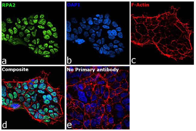 RPA2 Antibody in Immunocytochemistry (ICC/IF)