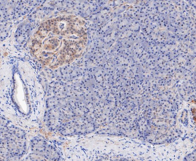 TPPP Antibody in Immunohistochemistry (Paraffin) (IHC (P))