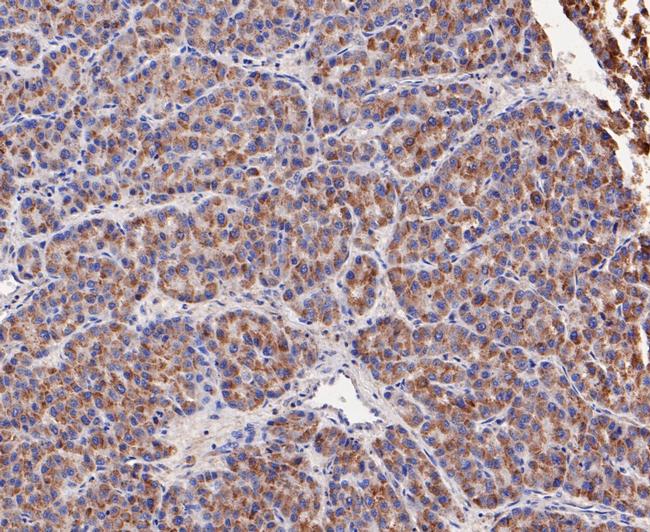 GSTK1 Antibody in Immunohistochemistry (Paraffin) (IHC (P))