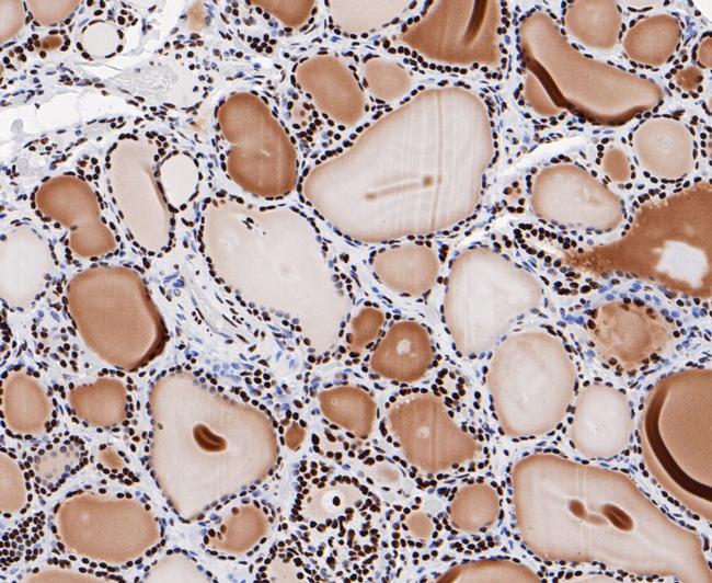 GTPBP4 Antibody in Immunohistochemistry (Paraffin) (IHC (P))