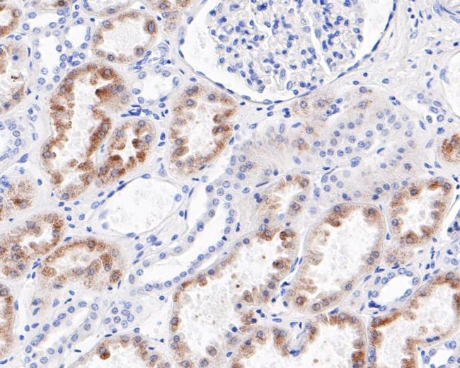 ENTPD5 Antibody in Immunohistochemistry (Paraffin) (IHC (P))