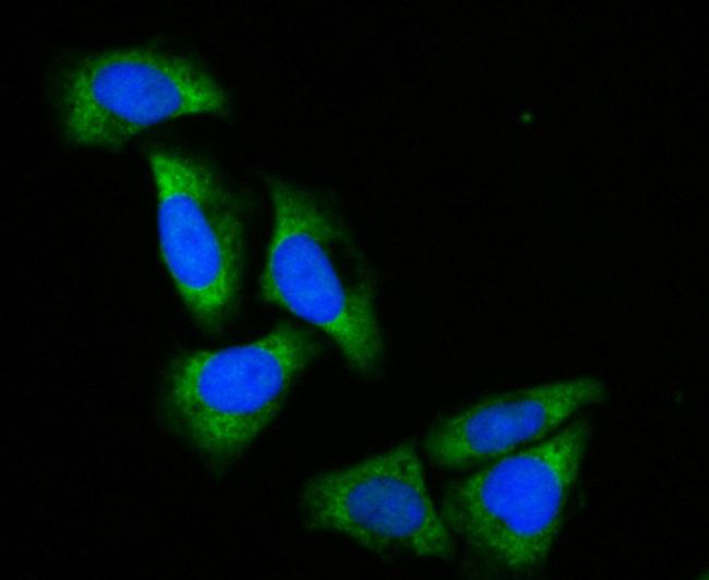 ACADM Antibody in Immunocytochemistry (ICC/IF)