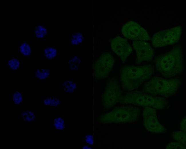 HSF2 Antibody in Immunocytochemistry (ICC/IF)